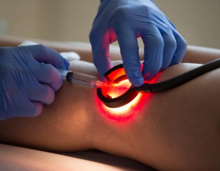 TRAP – Fleboterapia Rigenerativa Ambulatoriale Tridimensionale